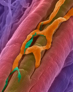 Heart or cardiac muscle with capillaries passing amongst the heart muscle fibers. Note the small varicose purkinje fiber adjacent to part of the capillary. Purkinje fibers are modified cardiac muscle fibers which originate from the atrioventricular node and spread into the two ventricles. They transmit the electrical impulse from the atrioventricular node to the ventricles enabling their almost simultaneous contraction. --- Image by © Dennis Kunkel Microscopy, Inc./Visuals Unlimited/Corbis